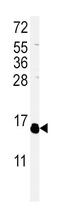 IL-4 antibody, PA5-25165, Invitrogen Antibodies, Western Blot image 