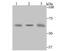 Cystathionine-Beta-Synthase antibody, NBP2-76982, Novus Biologicals, Western Blot image 