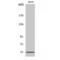 ETS Variant 1 antibody, LS-C383392, Lifespan Biosciences, Western Blot image 