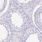 Ankyrin repeat domain-containing protein 1 antibody, HPA038736, Atlas Antibodies, Immunohistochemistry paraffin image 