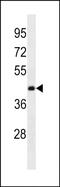 Ankyrin Repeat Domain 63 antibody, PA5-49152, Invitrogen Antibodies, Western Blot image 