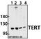 Telomerase Reverse Transcriptase antibody, A00012, Boster Biological Technology, Western Blot image 