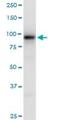 eEF-2 kinase antibody, H00029904-B01P, Novus Biologicals, Western Blot image 