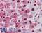 Nucleophosmin 1 antibody, LS-B2930, Lifespan Biosciences, Immunohistochemistry frozen image 