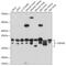 Tyrosine 3-Monooxygenase/Tryptophan 5-Monooxygenase Activation Protein Epsilon antibody, GTX55485, GeneTex, Western Blot image 