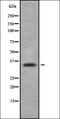 Cofilin 1 antibody, orb337443, Biorbyt, Western Blot image 
