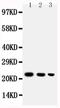 TNF Superfamily Member 13b antibody, PA5-80166, Invitrogen Antibodies, Western Blot image 