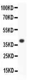 Arachidonate 15-Lipoxygenase antibody, PA5-78761, Invitrogen Antibodies, Western Blot image 