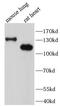 SLIT-ROBO Rho GTPase Activating Protein 2 antibody, FNab08225, FineTest, Western Blot image 