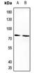 Interleukin 20 Receptor Subunit Alpha antibody, GTX55245, GeneTex, Western Blot image 