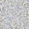 Carbonyl Reductase 3 antibody, FNab01325, FineTest, Immunohistochemistry paraffin image 