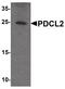 Phosducin Like 2 antibody, PA5-38056, Invitrogen Antibodies, Western Blot image 