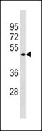 Zinc Finger And BTB Domain Containing 8A antibody, LS-C203839, Lifespan Biosciences, Western Blot image 