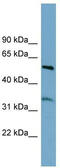 Threonine Synthase Like 2 antibody, TA344888, Origene, Western Blot image 