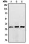 TIMP Metallopeptidase Inhibitor 3 antibody, LS-C352942, Lifespan Biosciences, Western Blot image 