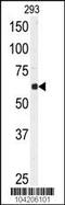 Ubiquitin Specific Peptidase 3 antibody, 61-095, ProSci, Western Blot image 