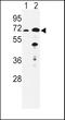 Enoyl-CoA Hydratase And 3-Hydroxyacyl CoA Dehydrogenase antibody, 63-561, ProSci, Western Blot image 