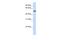 Pyridine Nucleotide-Disulphide Oxidoreductase Domain 2 antibody, A17172, Boster Biological Technology, Western Blot image 