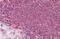Thrombospondin 1 antibody, NBP1-52410, Novus Biologicals, Immunohistochemistry paraffin image 
