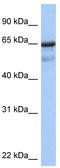 Phosphoenolpyruvate carboxylase antibody, TA331173, Origene, Western Blot image 