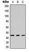 Casein Kinase 2 Alpha 1 antibody, LS-C358961, Lifespan Biosciences, Western Blot image 