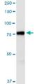 ArfGAP With GTPase Domain, Ankyrin Repeat And PH Domain 1 antibody, H00116987-M01-100ug, Novus Biologicals, Western Blot image 