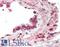 Melanoma Cell Adhesion Molecule antibody, LS-B11486, Lifespan Biosciences, Immunohistochemistry paraffin image 