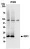 Retention In Endoplasmic Reticulum Sorting Receptor 1 antibody, NBP2-37700, Novus Biologicals, Immunoprecipitation image 