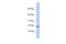 Host Cell Factor C1 Regulator 1 antibody, A14248, Boster Biological Technology, Western Blot image 