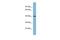 Fibronectin Type III Domain Containing 11 antibody, PA5-44121, Invitrogen Antibodies, Western Blot image 