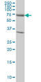 Exocyst Complex Component 7 antibody, LS-C133704, Lifespan Biosciences, Western Blot image 