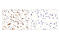 CD36 Molecule antibody, 14347S, Cell Signaling Technology, Immunohistochemistry paraffin image 