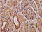 Propionyl-CoA Carboxylase Subunit Beta antibody, LS-C670992, Lifespan Biosciences, Immunohistochemistry paraffin image 