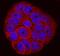 Integrin Subunit Beta 6 antibody, PA5-47588, Invitrogen Antibodies, Immunocytochemistry image 