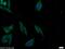 Autophagy Related 2B antibody, 25155-1-AP, Proteintech Group, Immunofluorescence image 