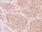 NADH:Ubiquinone Oxidoreductase Subunit S5 antibody, PA5-27542, Invitrogen Antibodies, Immunohistochemistry paraffin image 