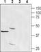 Calcium Release Activated Channel Regulator 2A antibody, PA5-77366, Invitrogen Antibodies, Western Blot image 
