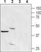 Calcium Release Activated Channel Regulator 2A antibody, PA5-77366, Invitrogen Antibodies, Western Blot image 