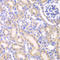 Adenylate Kinase 4 antibody, LS-C331854, Lifespan Biosciences, Immunohistochemistry paraffin image 
