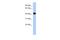 RasGEF Domain Family Member 1C antibody, A18616, Boster Biological Technology, Western Blot image 