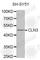 CLN3 Lysosomal/Endosomal Transmembrane Protein, Battenin antibody, A1931, ABclonal Technology, Western Blot image 