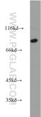 Calpain 7 antibody, 13870-1-AP, Proteintech Group, Western Blot image 