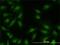 MAPK Activated Protein Kinase 2 antibody, H00009261-M01, Novus Biologicals, Immunofluorescence image 