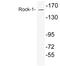 Rho Associated Coiled-Coil Containing Protein Kinase 1 antibody, LS-C291734, Lifespan Biosciences, Western Blot image 