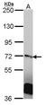 Ran GTPase Activating Protein 1 antibody, GTX106338, GeneTex, Western Blot image 