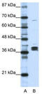 Heterogeneous nuclear ribonucleoprotein D-like antibody, TA345919, Origene, Western Blot image 