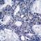 Zeta Chain Of T Cell Receptor Associated Protein Kinase 70 antibody, 79-348, ProSci, Immunohistochemistry frozen image 