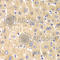 Inositol Monophosphatase 1 antibody, A6381, ABclonal Technology, Immunohistochemistry paraffin image 