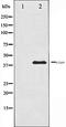 Jun Proto-Oncogene, AP-1 Transcription Factor Subunit antibody, orb106332, Biorbyt, Western Blot image 
