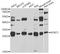 N-Terminal Xaa-Pro-Lys N-Methyltransferase 1 antibody, A7098, ABclonal Technology, Western Blot image 